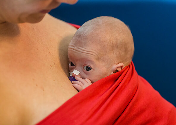 Bonding-Top rouge avec un bébé prématuré
